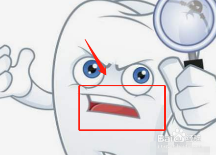 奶瓶齿龋能修复吗