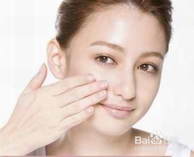 面部黄褐斑怎么办