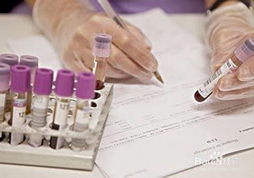 怀孕时有糖尿病应该注意什么