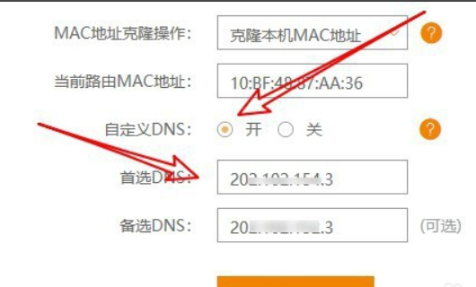 wan口设置怎么设置