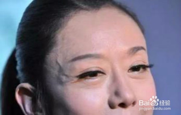 “青筋”突出是怎么回事