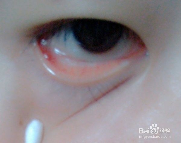 如何自我判断是否快要生病