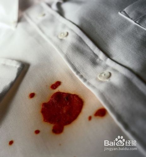 如何去除衣服上墨渍