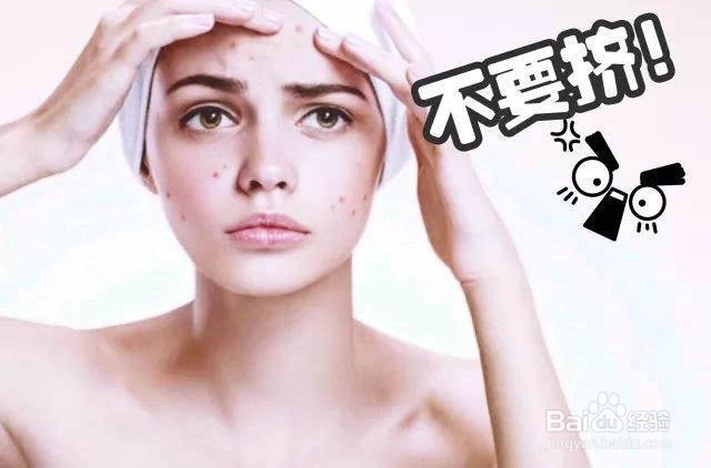 脸上有痘痘怎么办 自己调理方法好
