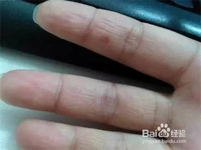 身体垃圾超标的六个信号