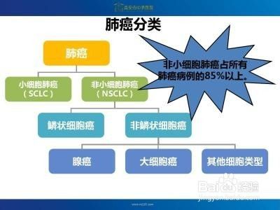 非小细胞肺癌还能治愈吗 百度经验