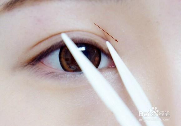 单眼皮怎么变成双眼皮?