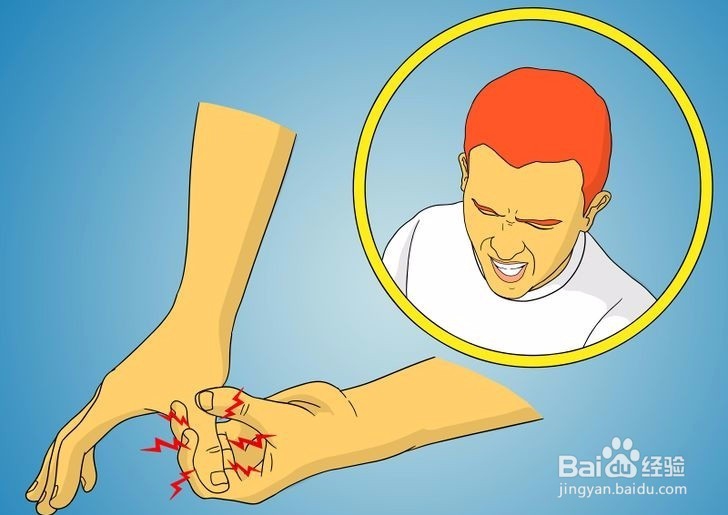 如何诊断拇指是否骨折?