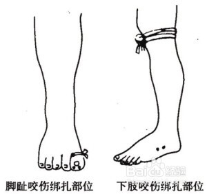 被蛇咬了怎么办? 自救小知识