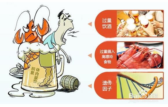 痛风病人不能吃的食物