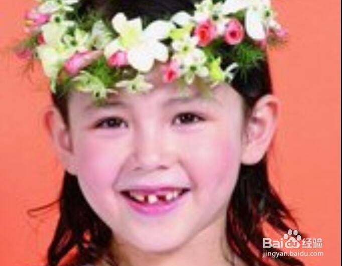 孩子换牙时该注意些什么？