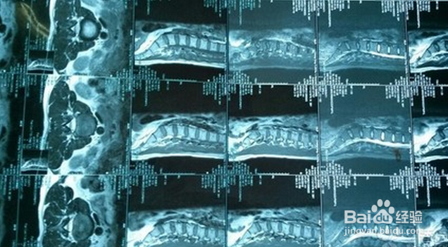 小孩便秘会引起正常发育吗?