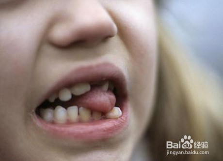小儿牙齿保健