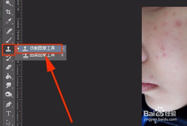 如何用ps把照片上痘痘去掉