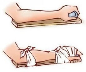 外出旅行的各种急救措施有哪些？