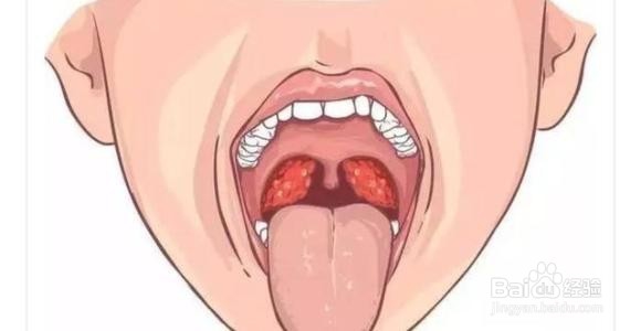 肾炎病的患者都有哪些表现?