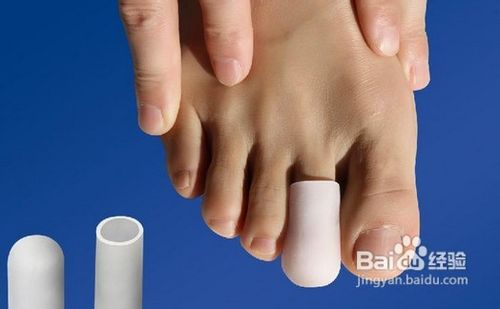 脚趾甲发白|是怎么回事|要怎么办