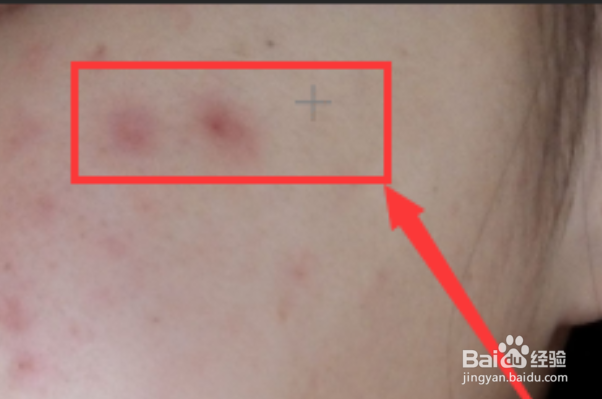 如何用ps把照片上痘痘去掉