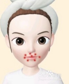 脸上长痘的原因和治疗方法你学会了吗