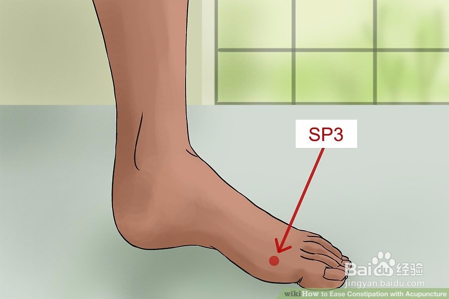 如何用针灸缓解便秘