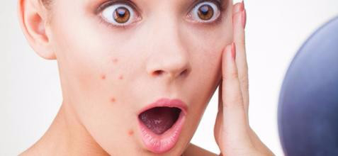 挤痘痘的危害与去痘的有效方法