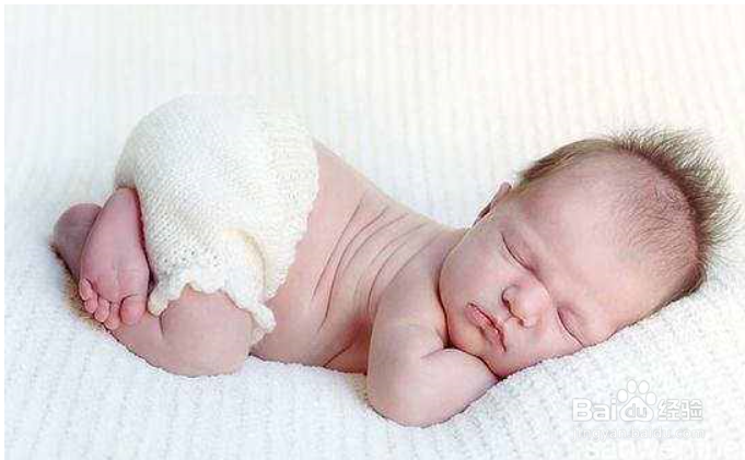 刚出生婴儿腿弯怎么办