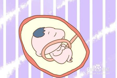 胎宝宝脐带绕颈危险大吗孕妈妈应该做些什么