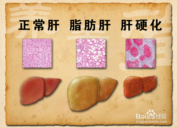 生气会让肝气郁结