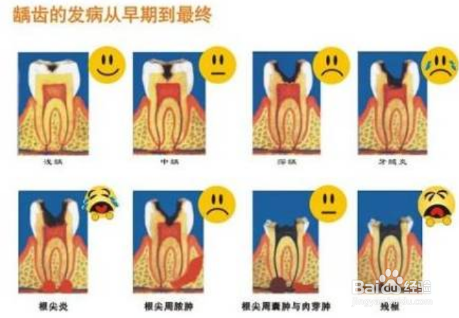 牙龈萎缩的形成及其原因