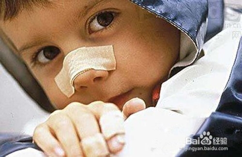 四大法宝对抗过敏鼻炎