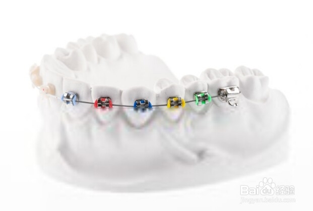 <b>牙齿矫正之后要做到的几个护理措施</b>