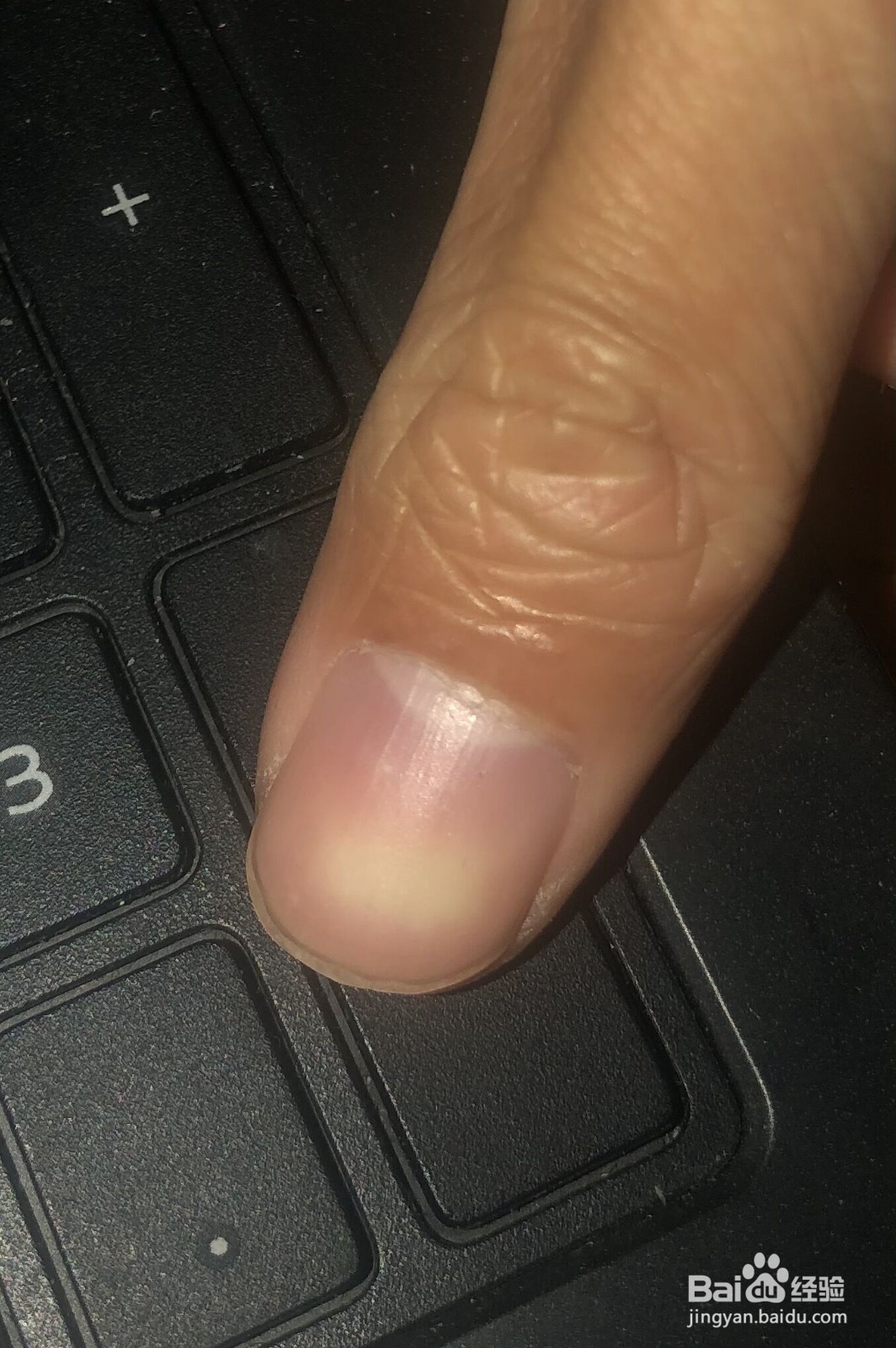 笔记本按键失灵如何修复