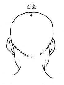 百病拔罐：[17]健忘的拔罐疗法