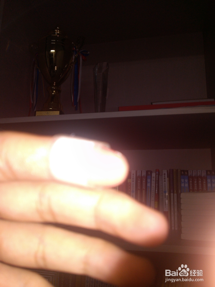 手被烫伤怎么办?