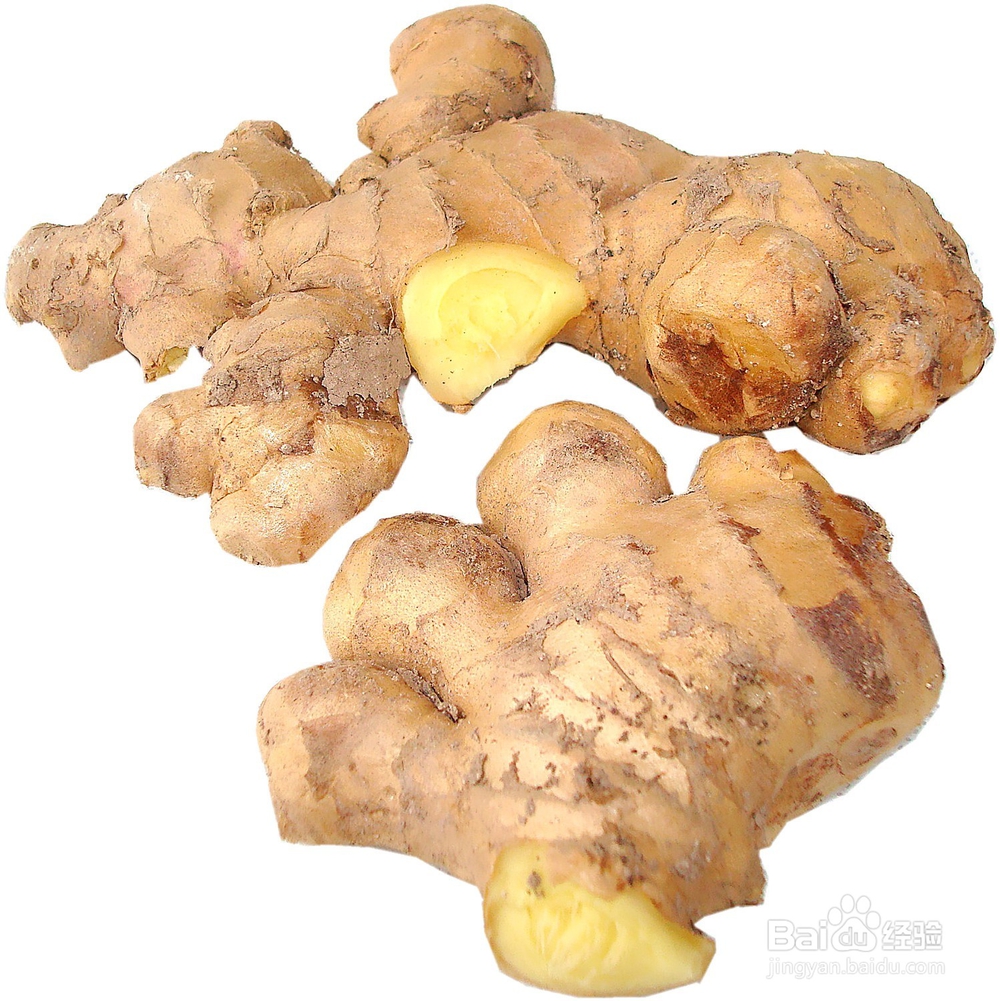 怎样改善静脉曲张