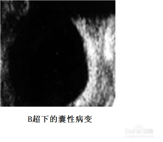 乳房肿块要做哪些检查
