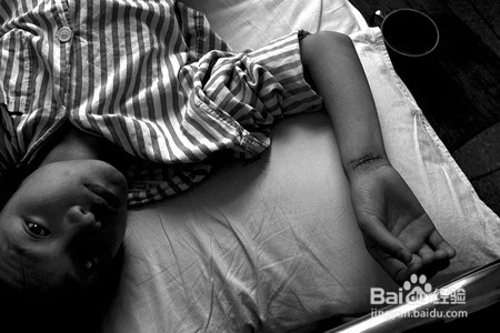 患上抑郁症也是有症状的,你知道吗?