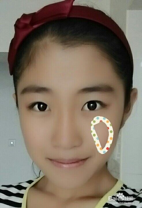 脸上痘痘的位置告诉你哪里出了问题