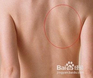 后背疼痛怎么办 缓解后背疼的方法 百度经验 后背疼痛怎么办 缓解后背疼的方法 百度经验