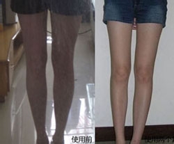 简单的瘦腿方法