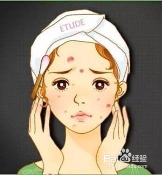 什么去痘印管用?分清类型有效祛痘印