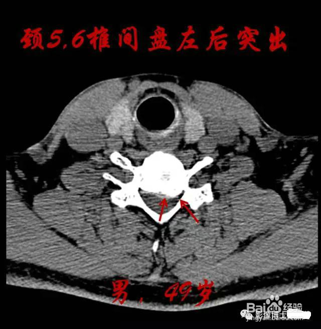 乳胶枕的好处 作用
