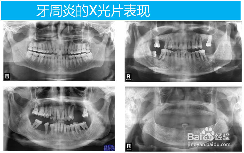 教您如何科学刷牙 8020牙齿 预防宣教
