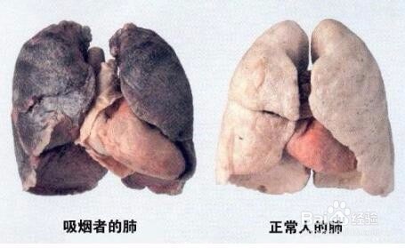 戒烟戒不掉?下面总有一种方法适合你