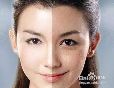 秋季皮肤经常性暗黄怎么美白