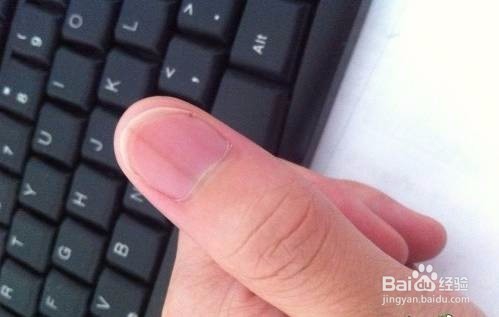 从你的手指头就可以看出健康问题!准爆!