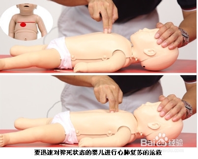教您夏季如何急救防猝死