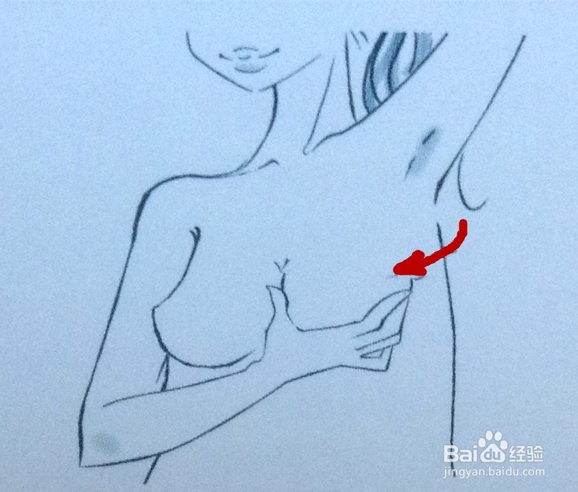 怎样预防妊娠纹