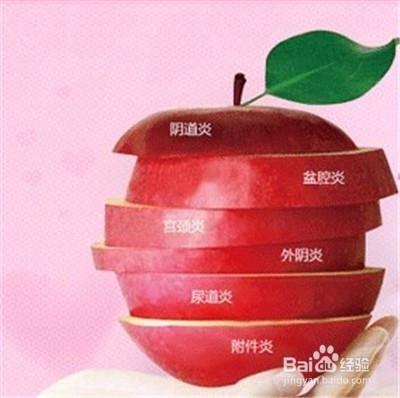 为什么阴道炎反复发作应该如何降低复发概率