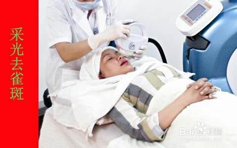 男生如何治疗满脸雀斑